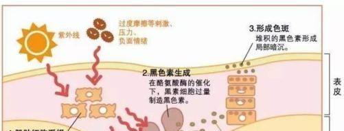如何有效清理打印机黑色素（简单实用的清洁方法）