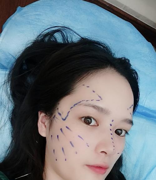 苹果手机面部识别最多支持几个人设置？设置方法是什么？